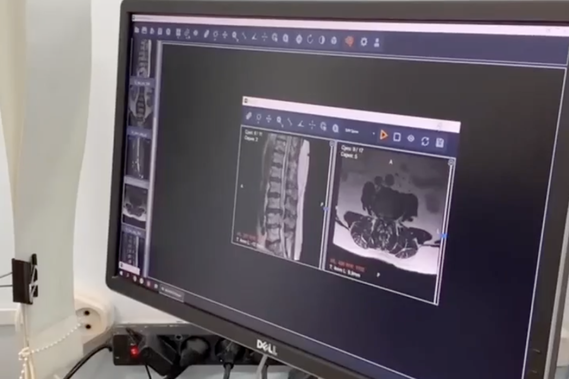 Первые в Югре: Нижневартовские врачи тестируют искусственный интеллект в МРТ-диагностике